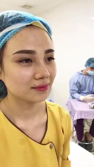 Cùng xem kết quả nâng mũi Demi 5D của cô gái xinh đẹp đến từ Phú Thọ