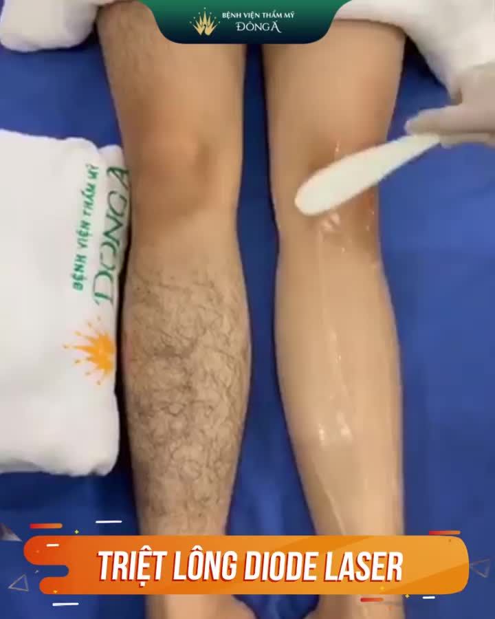 Đâu là cứu tinh cho cô gái 18 tuổi "chân vượn" đầy lông