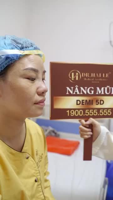 Cùng theo dõi kết quả của vị khách hàng sau khi nâng mũi Demi 5D tại Dr. Hải Lê
