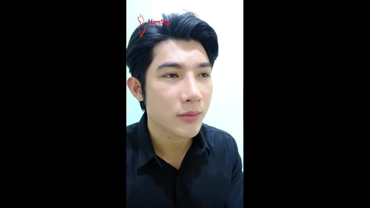 ĐẸP TỰ NHIÊN – THÔI MIÊN PHÁI ĐẸP với nâng mũi cấu  trúc lót sụn đa lớp cho phái mạnh
