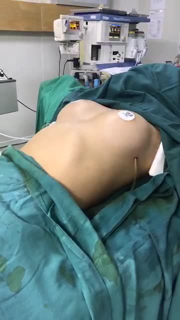 Kết quả độ loa cho ca NGỰC SIÊU PHẲNG