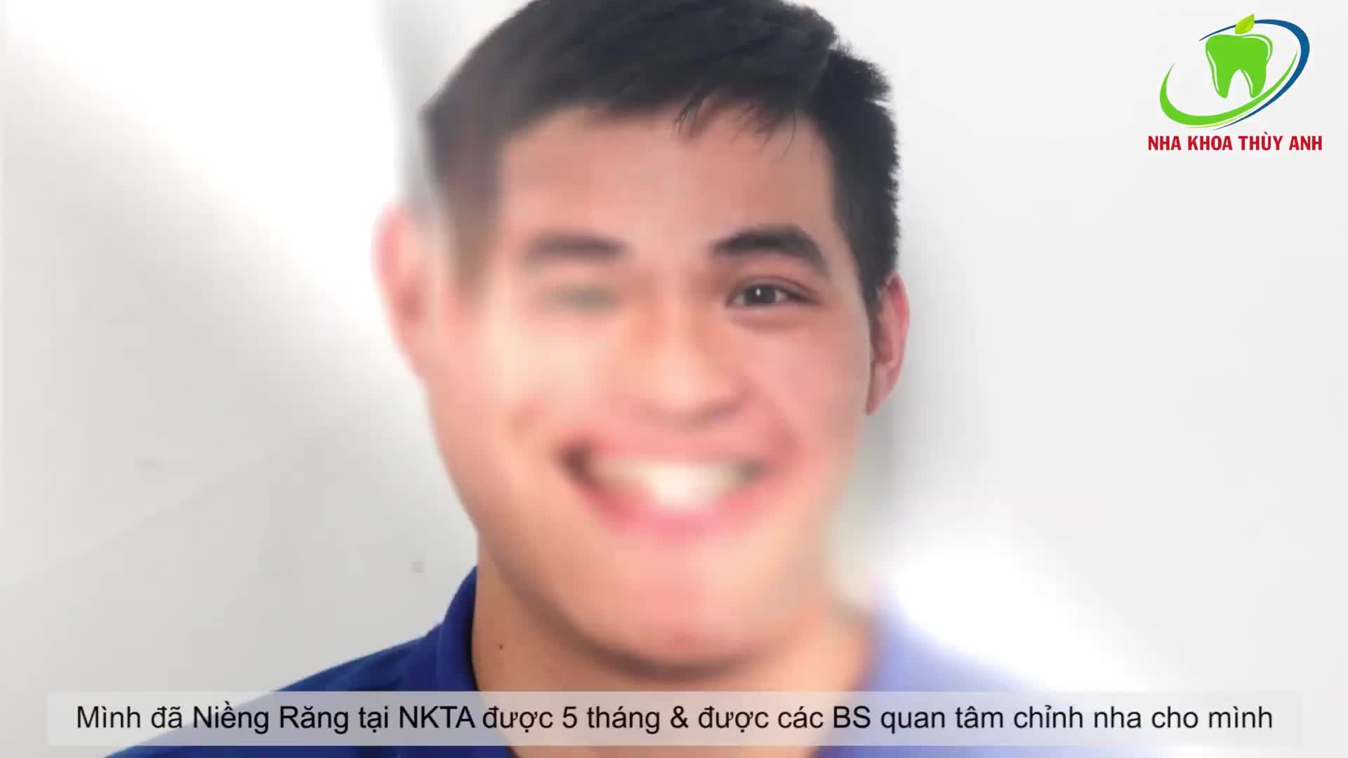 NIỀNG RĂNG THAY ĐỔI NỤ CƯỜI THỔI BAY NGÀN KHUYẾT ĐIỂM