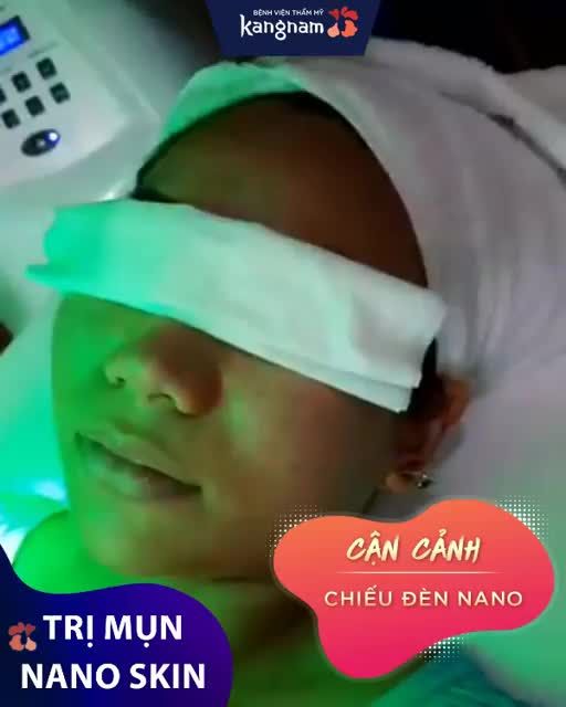 Sợ ĐAU khi NẶN MỤN? Chỉ cần chiếu đèn Nano