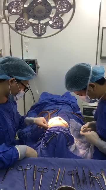 NÂNG MŨI CẤU TRÚC 4D - Tại sao 10.000+ người lựa chọn