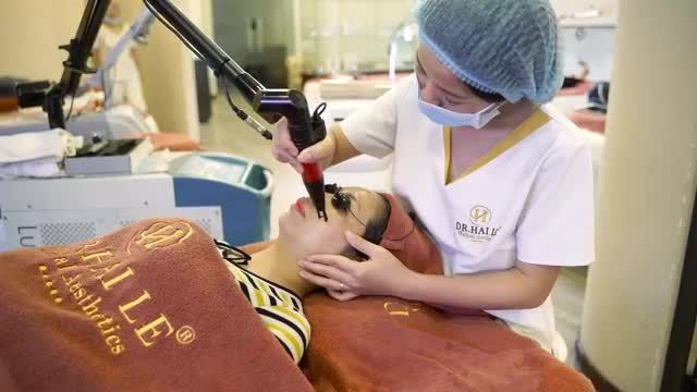 Trị tàn nhang 1 lần duy nhất bằng Công nghệ Laser Spectra – elos