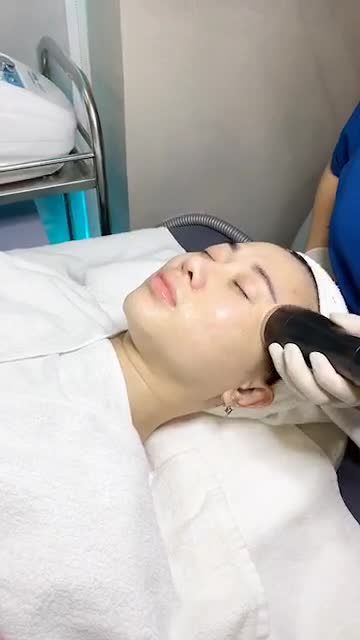 SẠCH MỤN sau 6 buổi Trị Mụn Nano Skin tại Kangnam 190 Trường Chinh, HN