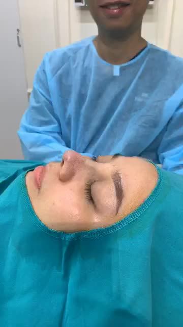 Màn lột xác ngoạn mục với NÂNG MŨI SIÊU CẤU TRÚC MEGADERM