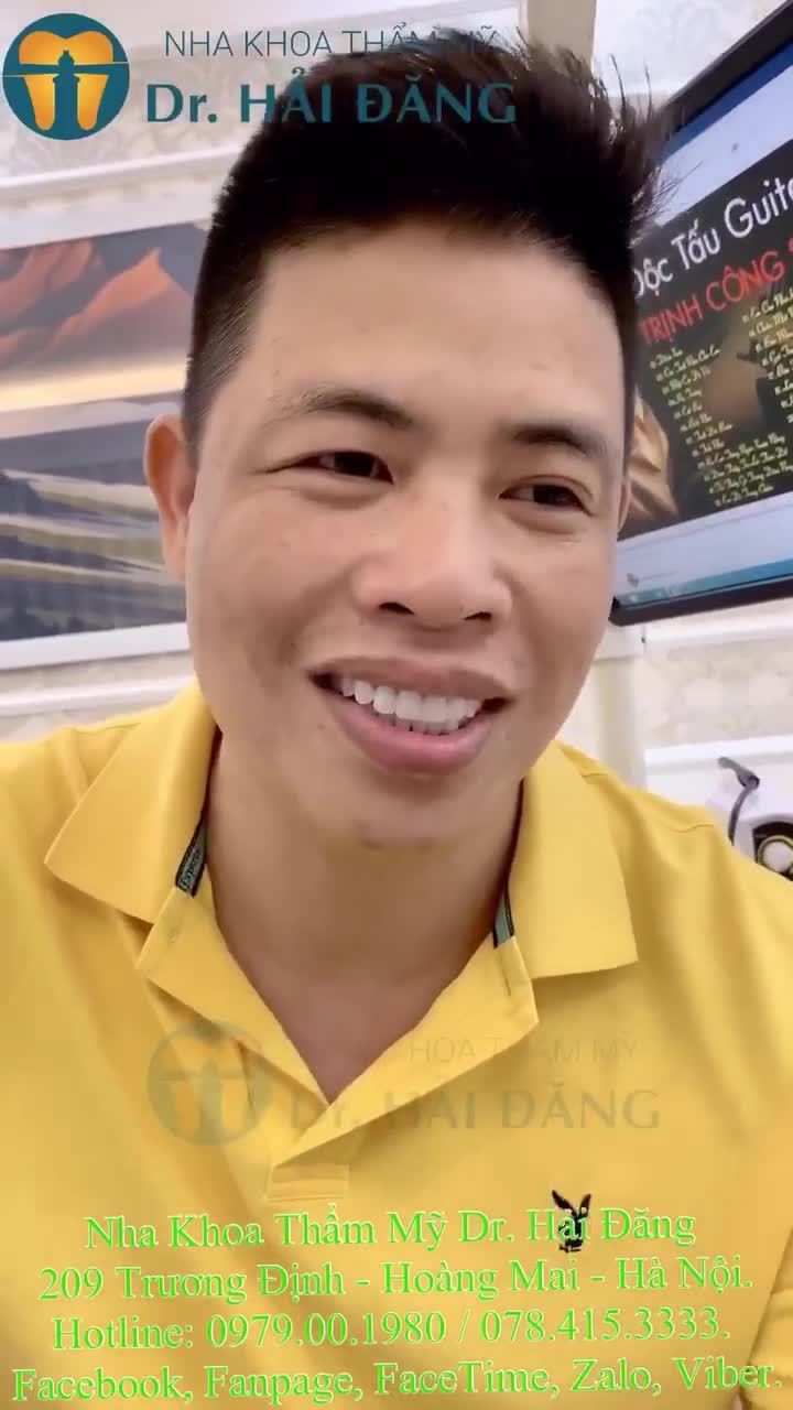 Toả sáng 25 răng sứ thẩm Mỹ cao cấp tại nhà khoa.