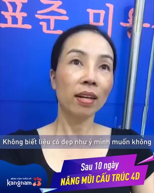 Khách hàng nghĩ sao khi Nâng mũi tại Kangnam?