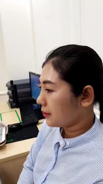 NÂNG MŨI CẤU TRÚC 4D sau cắt chỉ - Mũi đẹp tự nhiên, hoàn toàn không sưng bầm