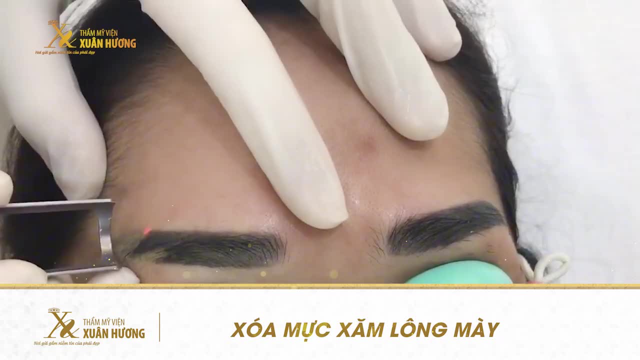 DÁNG LÔNG MÀY CŨ ĐÃ "LỖI MỐT", PHUN XĂM HỎNG HAY CHƯA ĐƯỢC NHƯ Ý MUỐN, PHẢI LÀM SAO?