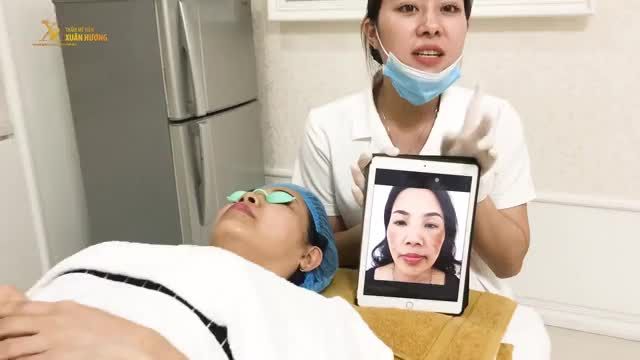 ĐIỀU TRỊ NÁM SAI CÁCH DẪN ĐẾN TĂNG SẮC TỐ