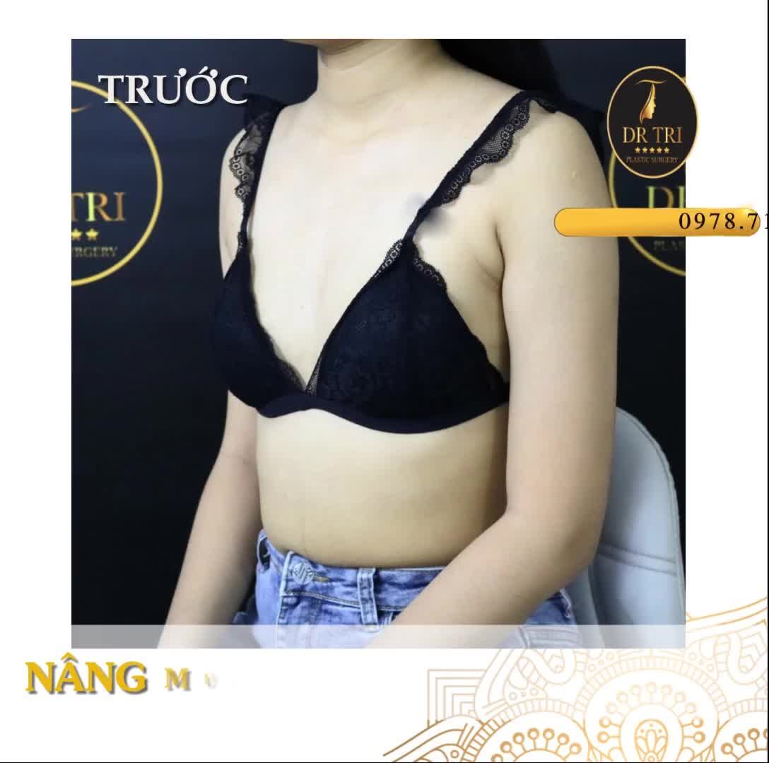 Hô biến diện mạo xinh đẹp trong chớp mắt tại Dr Trí