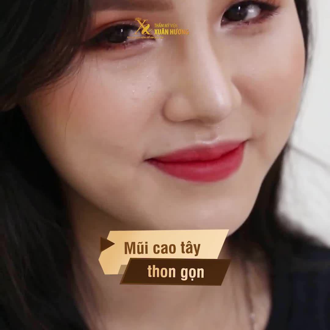 TIN HOT: GIA HẠN THÊM 9 NGÀY (01/10 - 09/10) NGÀY VÀNG NÂNG MŨI - NÂNG MŨI ERGONOMIC CHỈ 25 TRIỆU