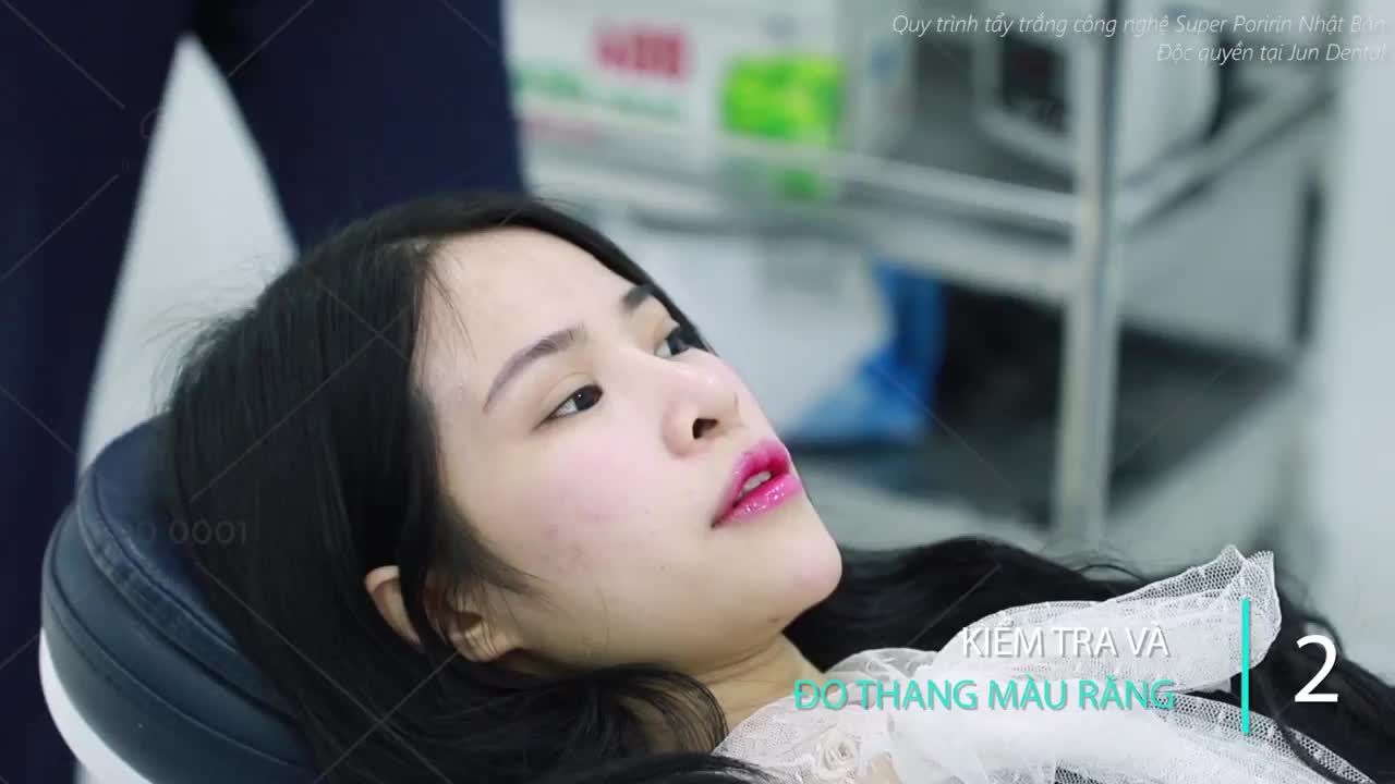 Công nghệ tẩy trắng răng từ Nhật Bản độc quyền tại Jun Dental