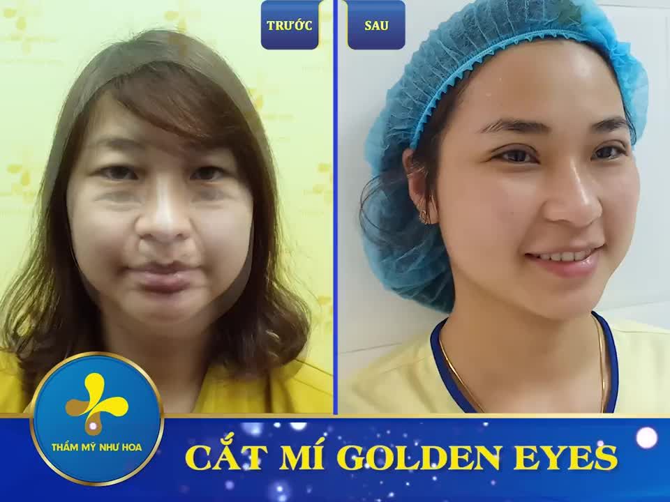 ĐÔI MẮT LÀ CỬA SỔ TÂM HỒN - NÊN PHẢI THẬT XINH