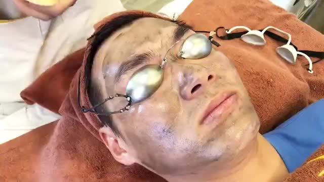 Điều trị trẻ hoá da bằng công nghệ Laser Spectra