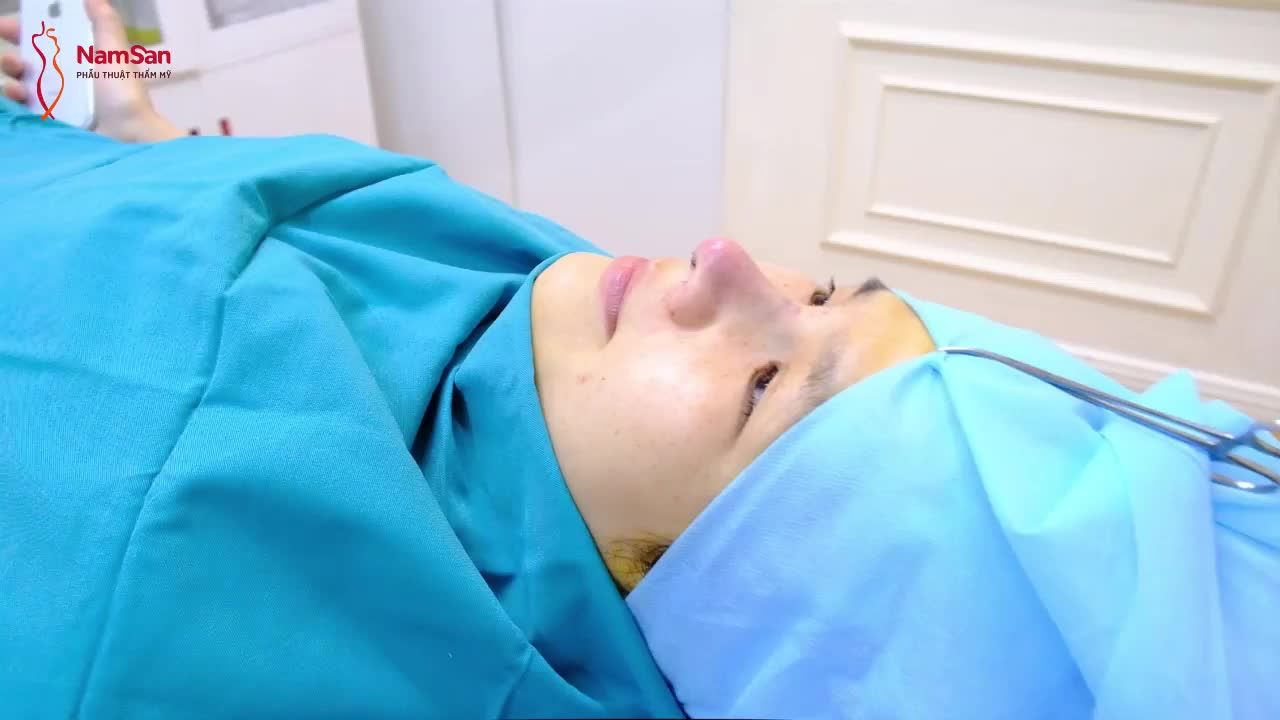 Dáng mũi đẹp ngay sau khi làm chỉ với NÂNG MŨI SIÊU CẤU TRÚC PUREFORM - Đẹp khó cưỡng!