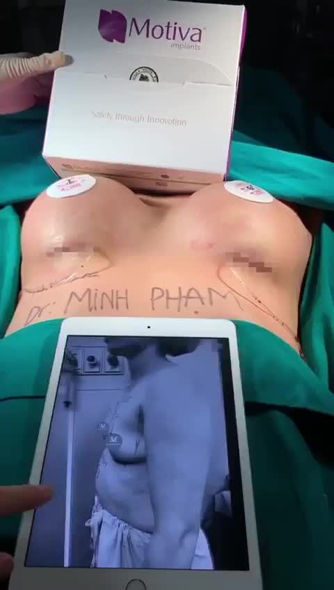 V1 CĂNG TRÒN - TỰ TIN TOẢ SÁNG
