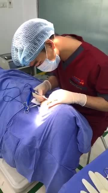 Tất tần tật các công đoạn THU NHỎ CÁNH MŨI thực hiện ra sao