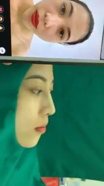 Bác sĩ Hoan cùng KH yêu đang nâng mũi tại Thẩm mỹ Dr.Hoan