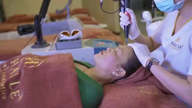 Cùng theo dõi quá trình điều trị nám bằng công nghệ Laser Diamond Square tại Dr. Hải lê