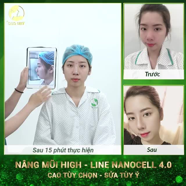 KẾT QUẢ hoàn hảo cho siêu phẩm mới Nâng mũi High Line NanoCell 4.0
