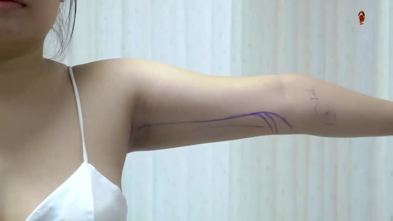 Từ ngày đón thêm một em Vaser Lipo về, các chị em chăm chỉ đi hút mỡ hơn!