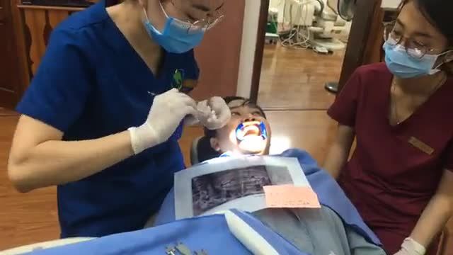 GẮN MẮC CÀI TẠI NHA KHOA THÙY ANH