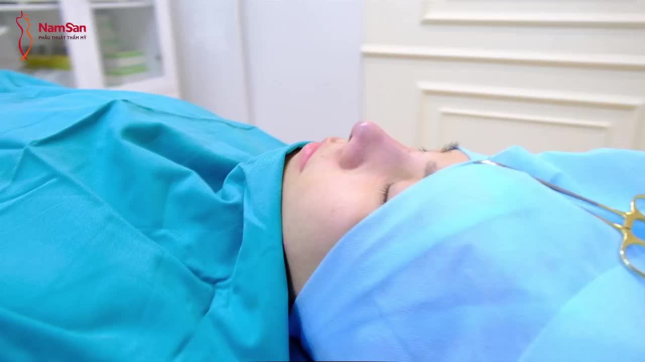 Nữ khách hàng 29 tuổi LỘT XÁC sau khi Nâng Mũi Siêu Cấu Trúc Pureform tại VTM NamSan