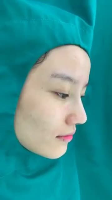 Quá trình nâng mũi bán cấu trúc - dựng thẳng trụ mũi cao bay