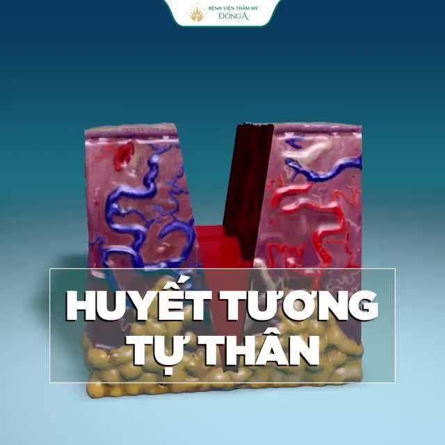 S.E0 LÕM RỖ khiến bạn mất tự tin