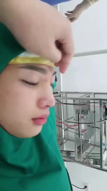 Tiếp tục ca nâng mũi chỉnh gồ tại thẩm mỹ Dr.Hoan