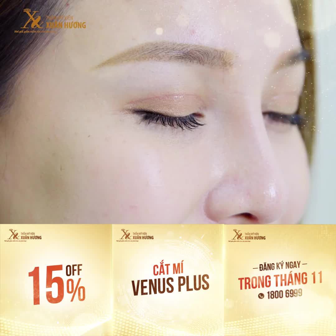 CHỈ 30 PHÚT CẮT MÍ MÍ MẮT ĐẦY KHUYẾT ĐIỂM HÓA MÍ ĐẸP XINH, TỰ NHIÊN KHÔNG DẤU VẾT