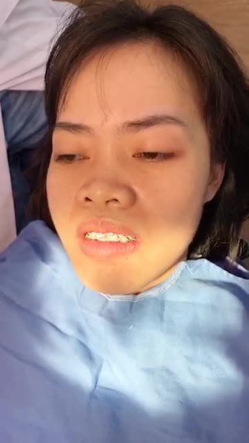 Quá trình Chỉnh nha - Niềng răng tại BVTM Kangnam