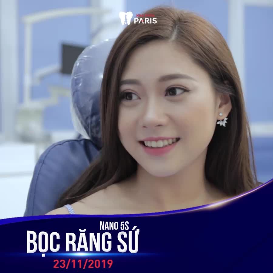 Ngày Hội Bọc Răng Sứ Tiêu Chuẩn Pháp Lớn Nhất Sài Gòn‼