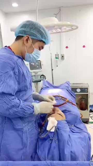 Quá trình gọt chất miệu - dựng cấu trúc đầu mũi - nâng mũi Cấu trúc 4D