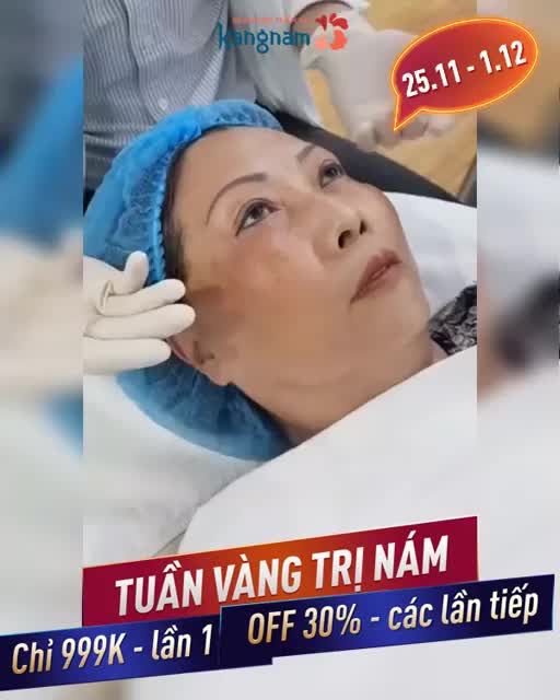 TRỊ NÁM GIÁ THẤP NHẤT NĂM - Đến tuần vàng Laser