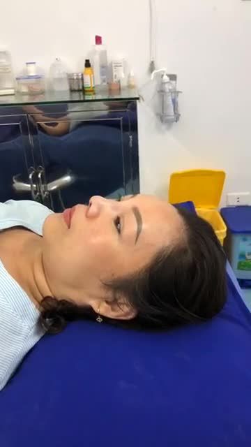 Tiếp tục ca mũi sửa siêu khó ngày hôm nay
