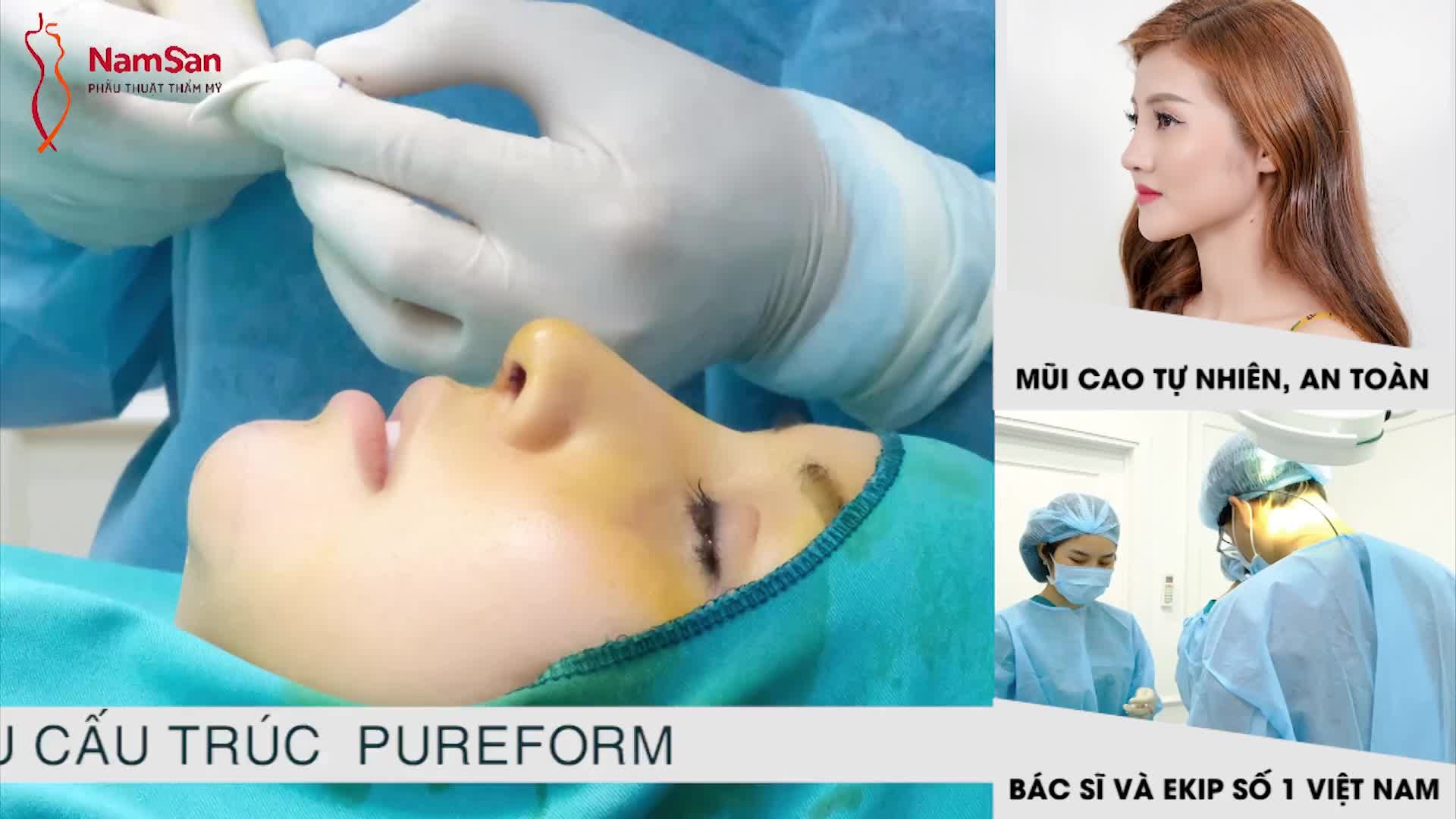 VÌ SAO NÊN CHỌN CHẤT LIỆU PUREFORM ĐỂ NÂNG MŨI?