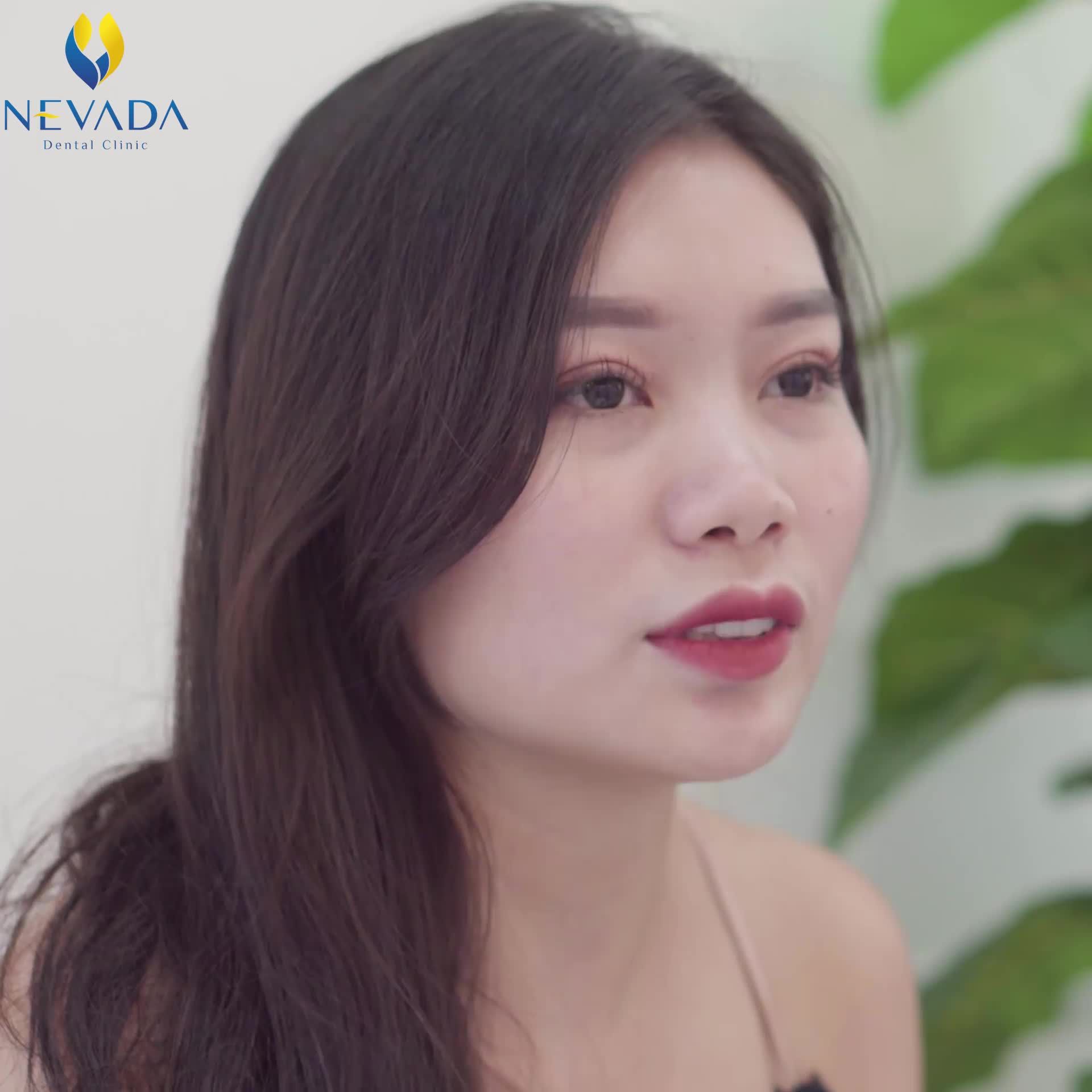 DÁN SỨ VENEER CÓ HIỆU QUẢ KHÔNG