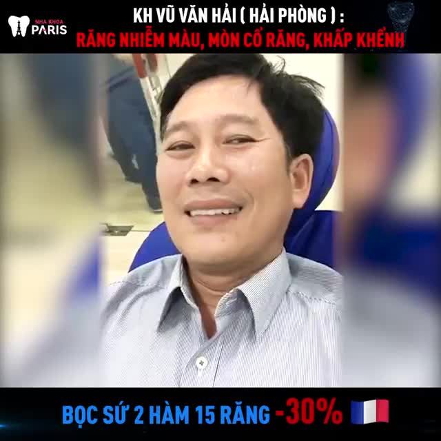 Kết Quả Bọc Răng Sứ 02 hàm 15R tại Nha Khoa Paris