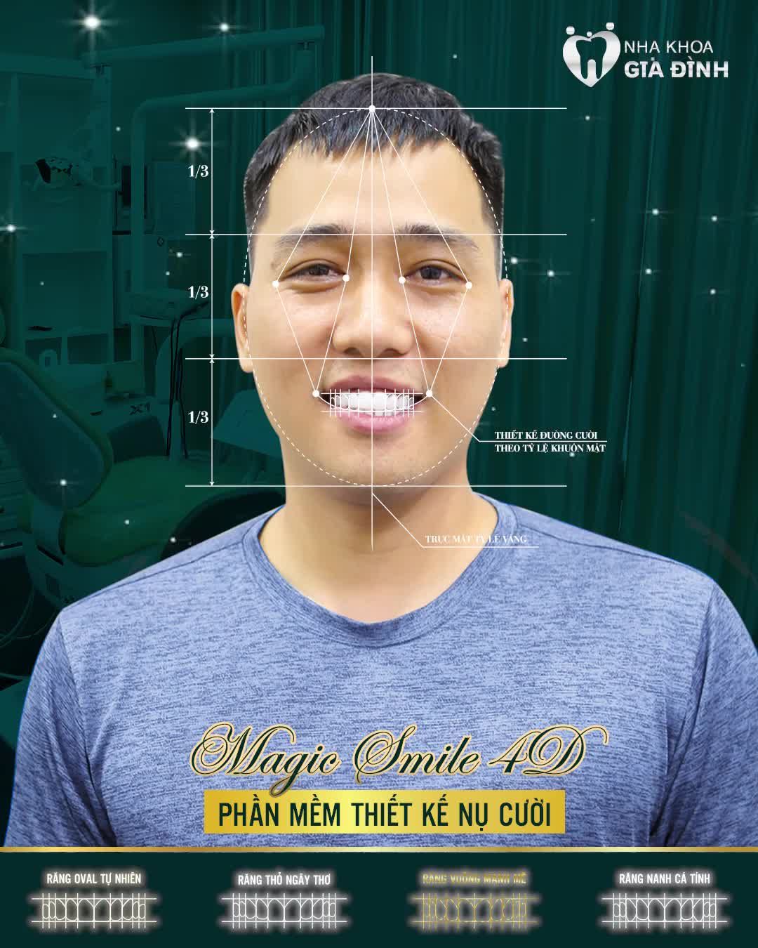 XÓA BỎ HÀM RĂNG Ố VÀNG, KHẤP KHỂNH NẶNG CHỈ SAU 2 NGÀY.