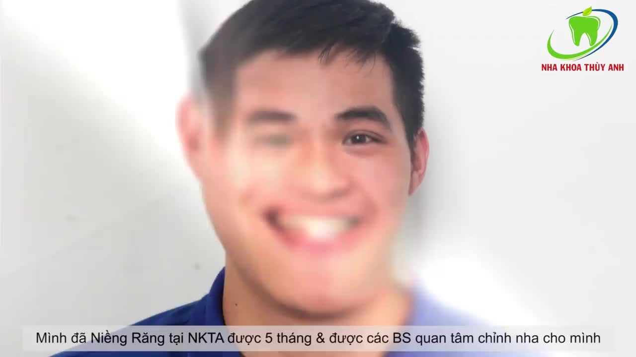 NIỀNG RĂNG - HÀNH TRÌNH TÌM LẠI NỤ CƯỜI KHÔNG DAO KÉO
