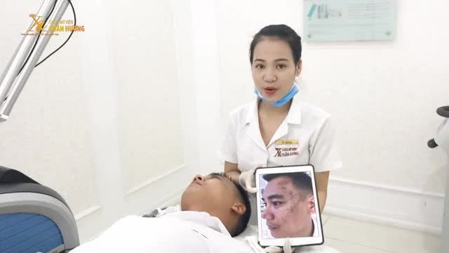 CHÀM BỚT SẪM MÀU, LAN RỘNG TRÊN MẶT