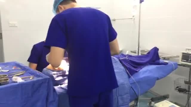 Kết quả Nâng mũi Sụn Cao Cấp Surgiform nhé cả nhà!