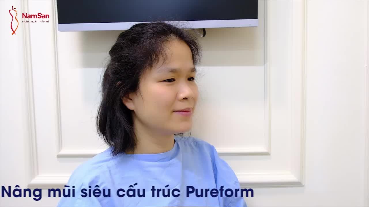 MÊ MẨN VỚI KẾT QUẢ NÂNG MŨI SIÊU CẤU TRÚC SAU 10 NGÀY