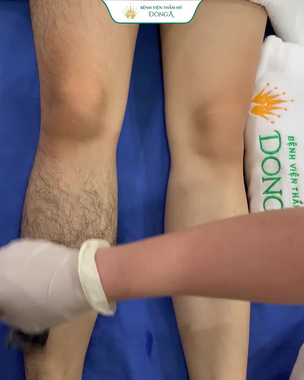 Lông rậm thế này, BIẾT LÀM THẾ NÀO ?