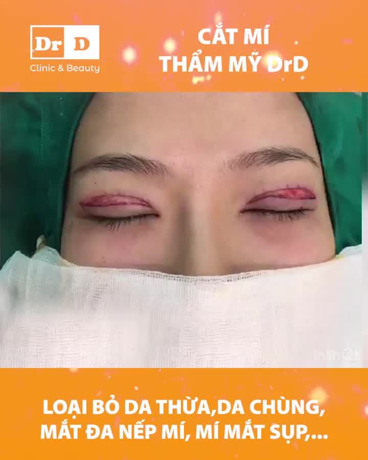 Mí đẹp tự nhiên...nhưng không tự nhiên mà đẹp