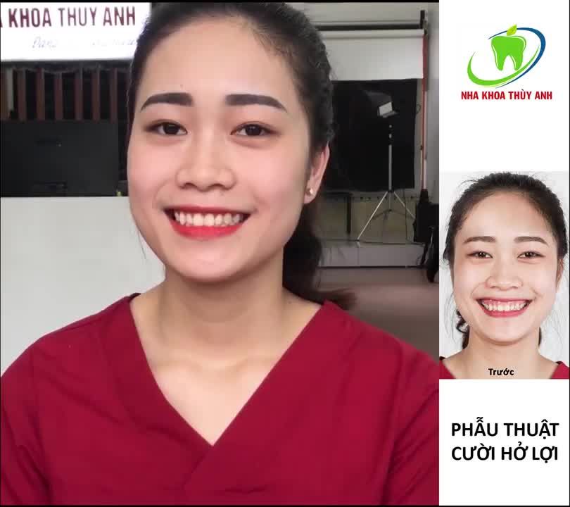 HOÀN THIỆN NỤ CƯỜI MỚI - CHẠM TỚI MỌI ƯỚC MƠ